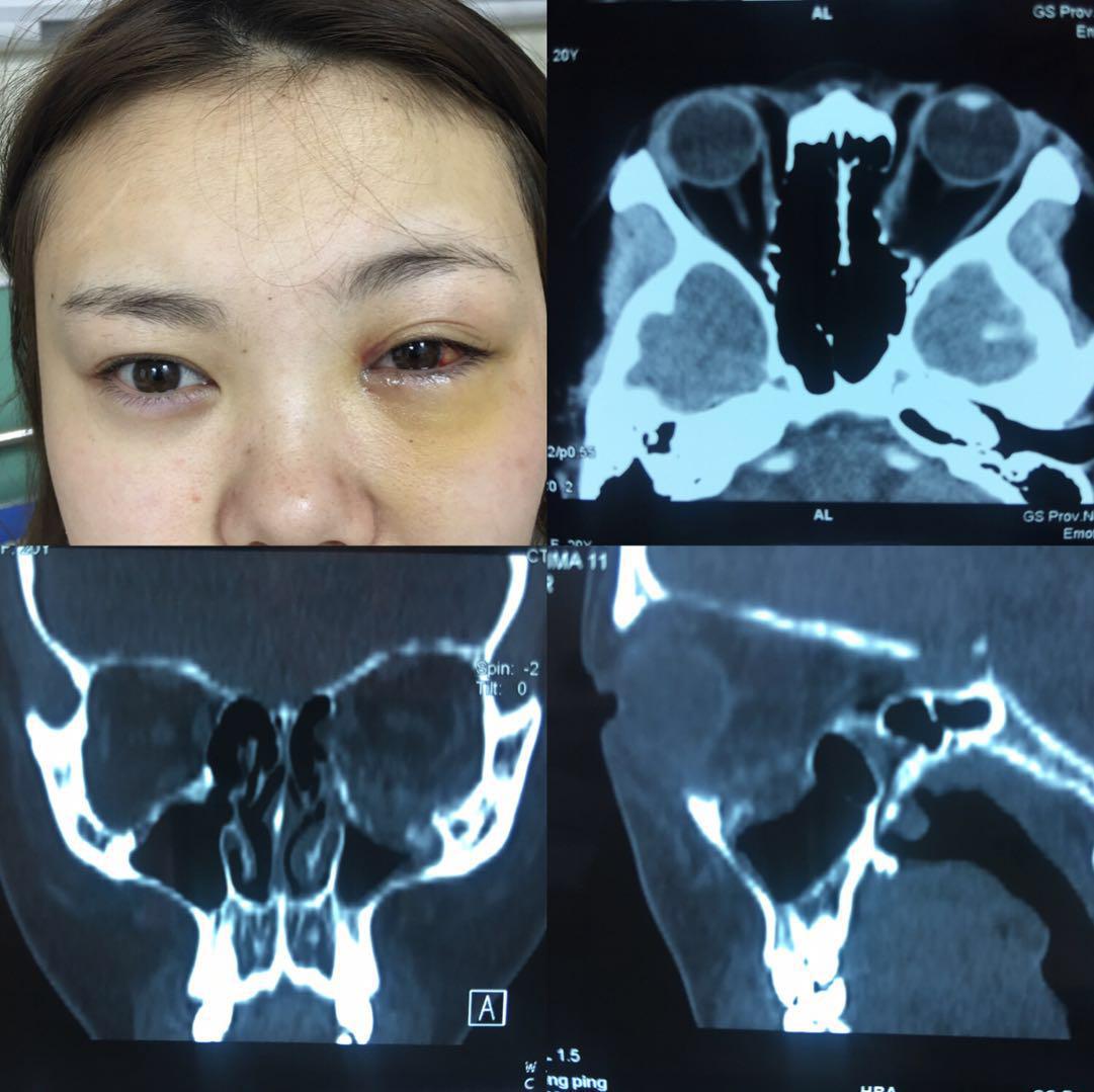 10.眼球和眶腔的矢状切面-眼耳鼻咽喉应用解剖-医学