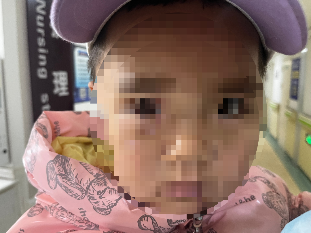 动物门诊用什么x光机揪心！2岁患儿被犬撕咬，省二院动物咬伤门诊这样手术为其保全“颜”面_https://www.jmylbn.com_新闻资讯_第5张